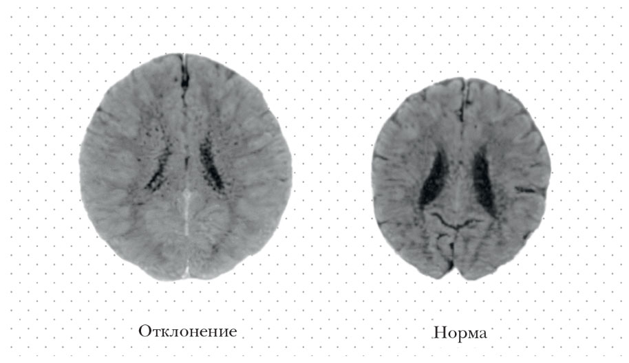 История твоего «я». Вся правда о deepfake